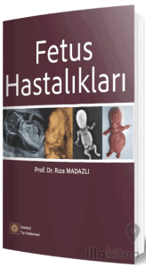 Fetus Hastalıkları