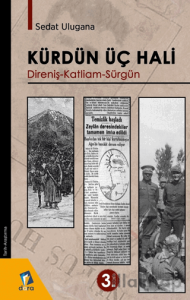 Kürdün Üç Hali