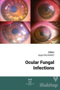 Ocular Fungal Infections