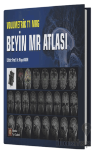 Volumetrik T1 MRG Beyin MR Atlası