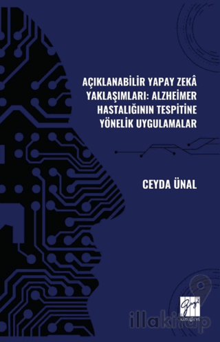 Açıklanabilir Yapay Zekâ Yaklaşımları: Alzheimer Hastalığının Tespitine Yönelik Uygulamalar