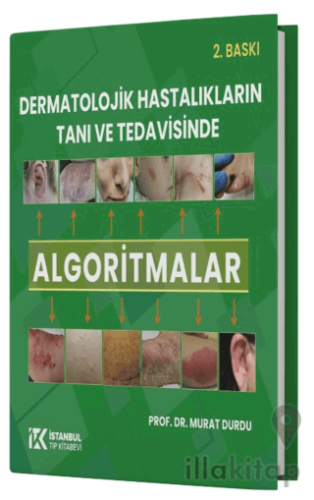 Dermatolojik Hastalıkların Tanı ve Tedavisinde Algoritmalar