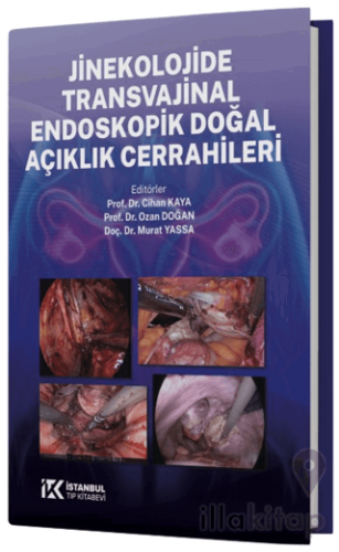 Jinekolojide Transvajinal Endoskopik Doğal Açıklık Cerrahileri