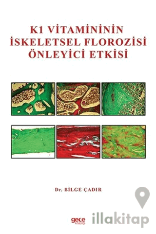 K1 Vitamininin İskeletsel Florozisi Önleyici Etkisi